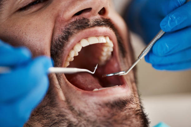 Best Tooth Infection Emergency Dentist  in Del Rey Oaks, CA